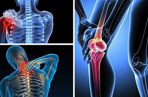 Uống nước có tốt cho xương khớp?